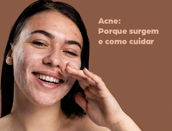 O problema de pele mais comum das brasileiras